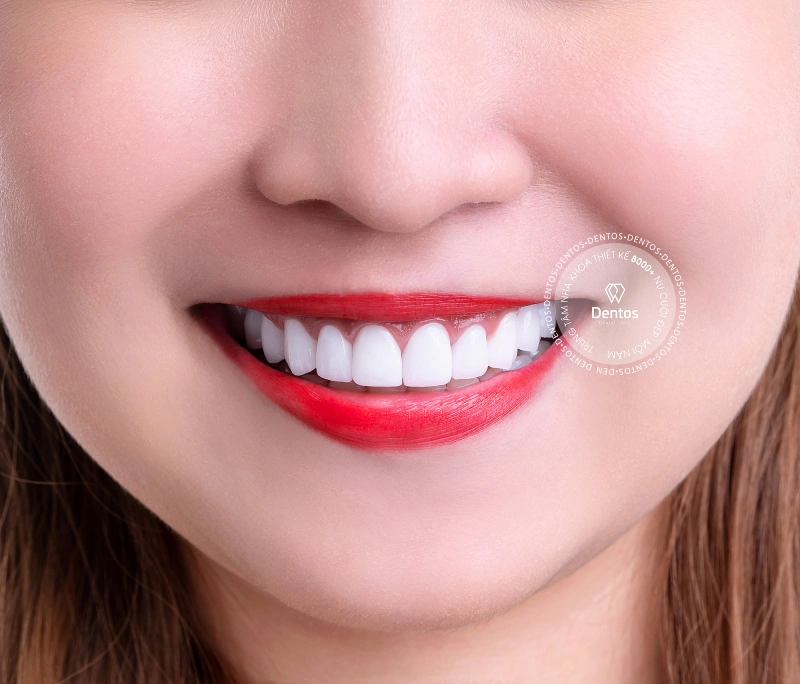 Bọc răng sứ có đau không? Cách khắc phục nếu bị đau?